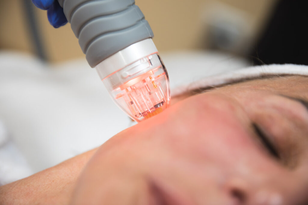 A female patient visiting the team at Spa 29 to receive treatments for facial contouring in Brunswick, GA.
