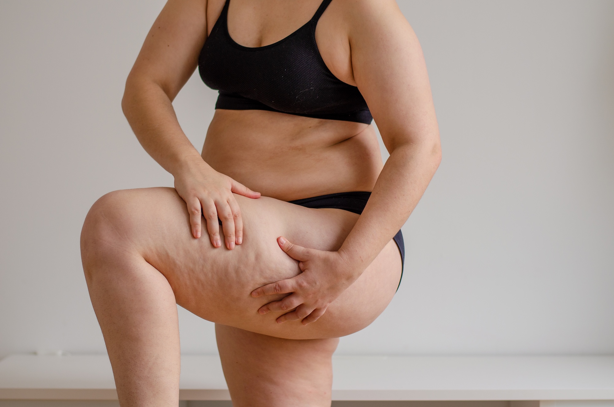 Image of a woman squeezing the cellulite on her skin before visiting Spa 29 for cellulite treatment near St. Simons Island, GA.